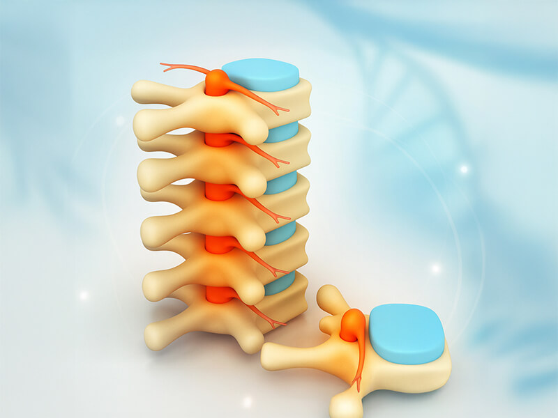 Spine surgery