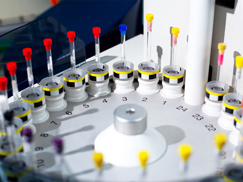 Diagnostic Tests for Thyroid | PAX Medicus Medical Tourism Agency