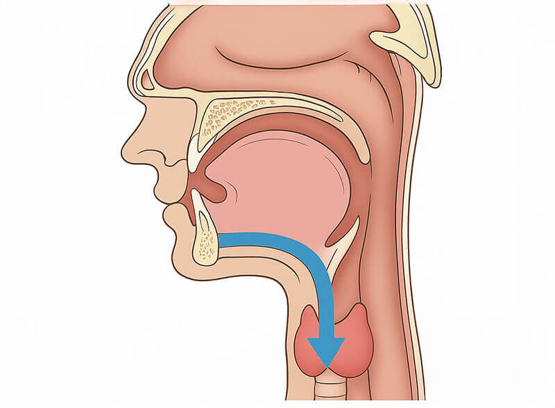 Transoral Approach Diagram | PAX Medicus Medical Tourism Agency