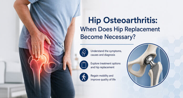 Hip Osteoarthritis: Symptoms & Hip Replacement